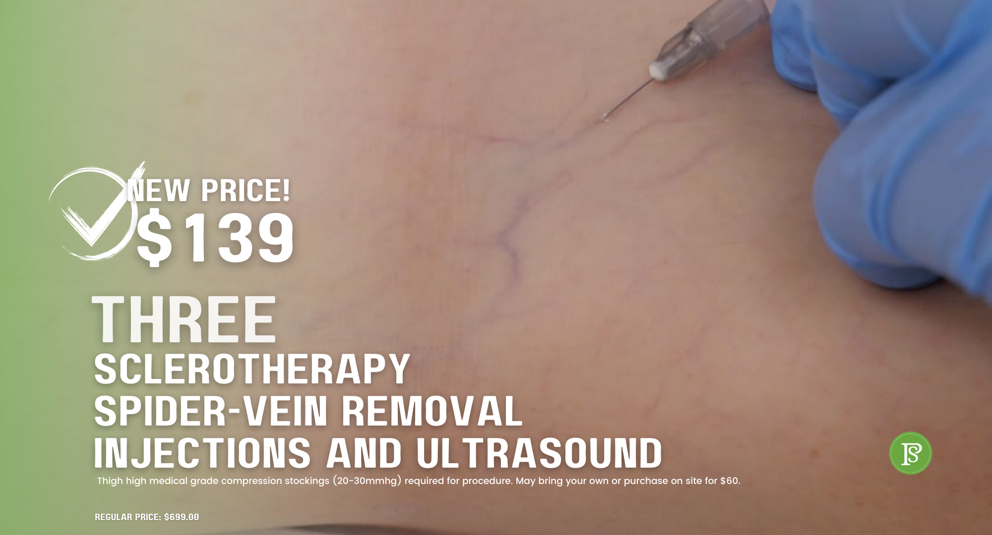 Sclerotherapy-Three – Skypoint Vein