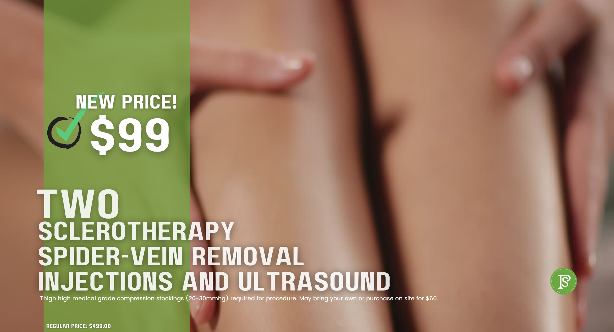 Sclerotherapy-Two- Skypoint Vein